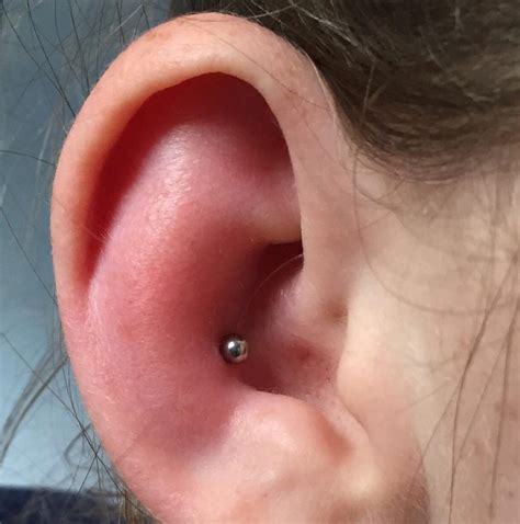 normal cartilage piercing swelling